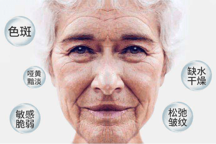 負氧離子